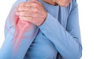Frozen Shoulder
