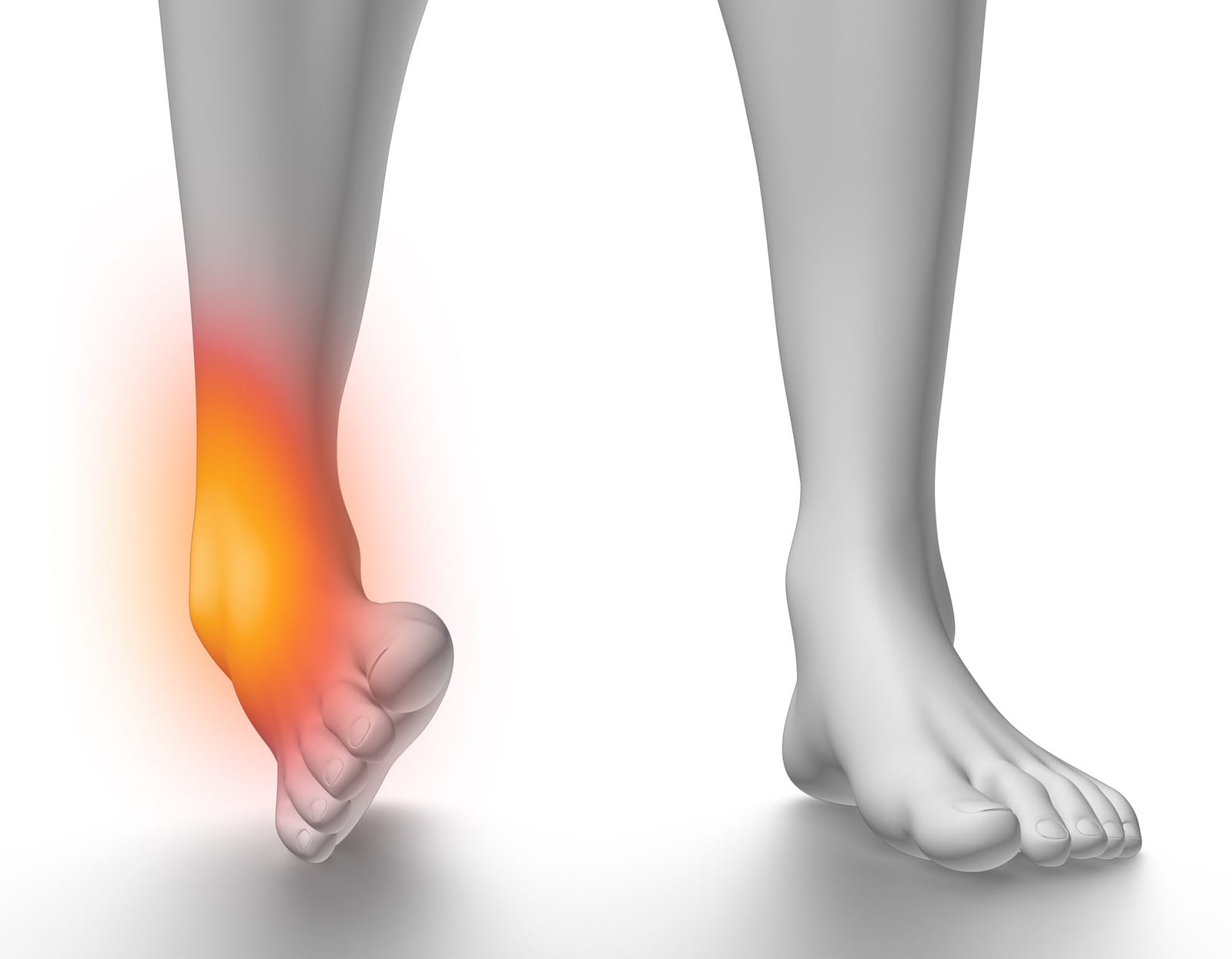 Sprain and Strain